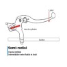 Maitre-cylindre de frein avant Nissin type semi-radial